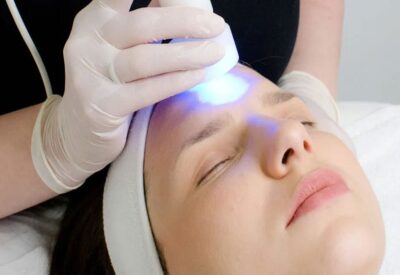 Picosecond Laser for Freckle Removal