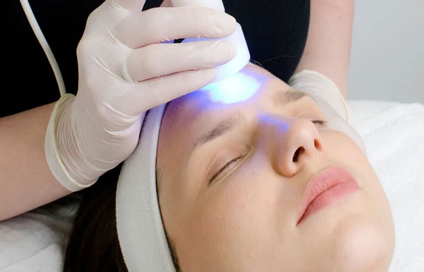 Picosecond Laser for Freckle Removal